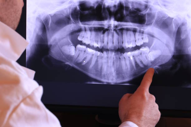 Best Emergency Treatment for Dental Infections or Abscesses in Moundsville, WV